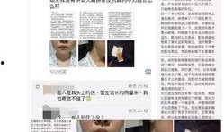 绵阳医美爆料事件最新情况,真相逐步浮出水面，行业监管再引关注
